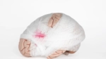 Handling Concussions Head On: What to Do and When